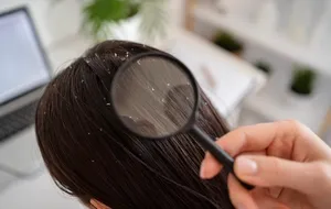 معرفی بهترین شامپو ضد شوره از برندهای ایرانی و خارجی