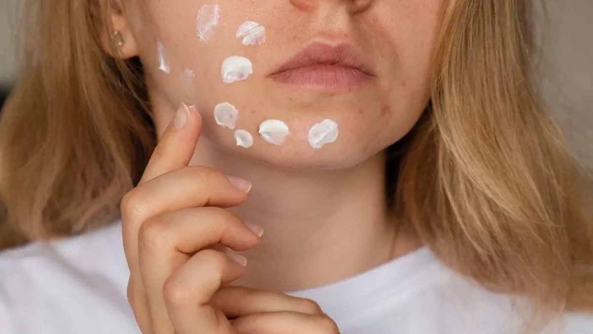 با بهترین کرم ضد لک قوی بدون بازگشت ایرانی و خارجی آشنا شوید